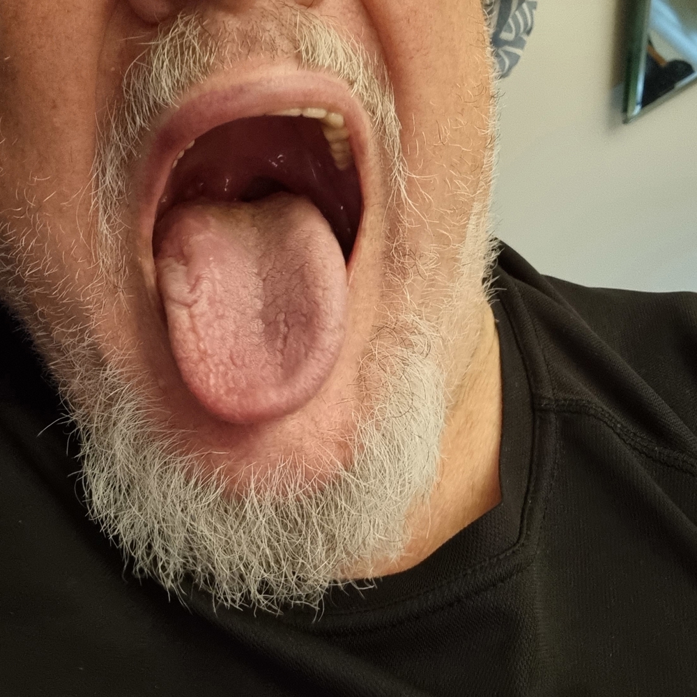 Meinen Mund und meine Zunge