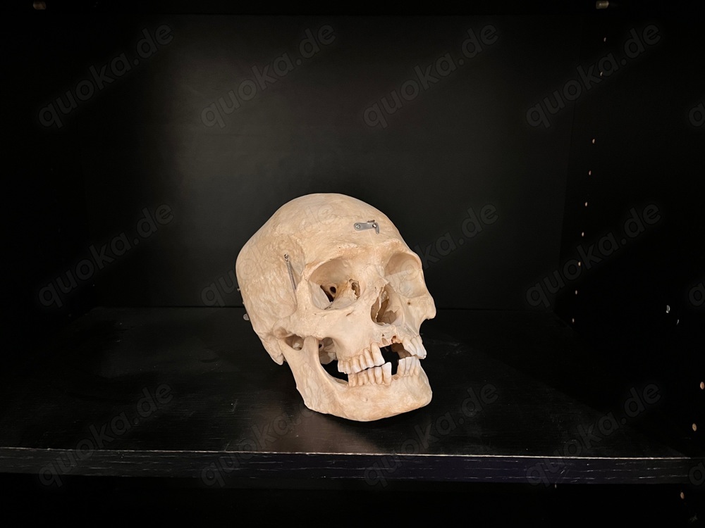 Anatomie präparierter Schädel original