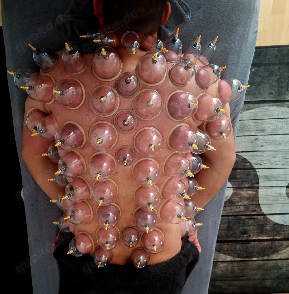 Schröpfen  Massage - gegen Verspannungen, Schmerzen, Stoffwechsel, Faszie & Energie - Körper & Geis