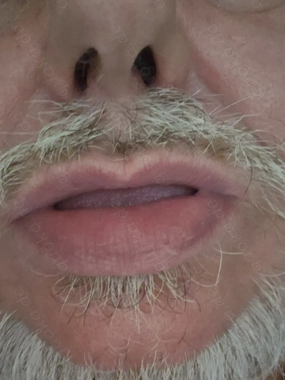 Blasemaul und NS Maul