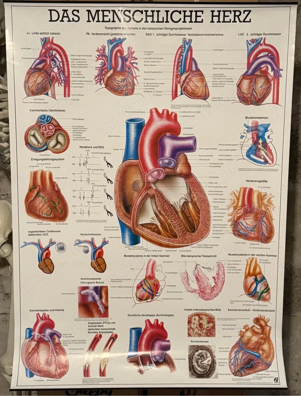 Anatomie-Poster: Das menschliche Herz (XL-Format)