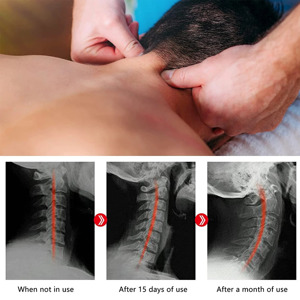 Akupressur Massagegerät für Kopf Schulter Nacken Wirbelsäule gegen Fehlhaltung und zur Entspannung Bild 2