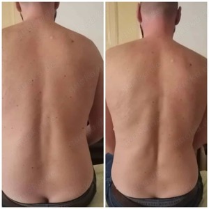 Chiropraktiker Kinesiology & Madero Therapie Aktion nur 90  Bild 3