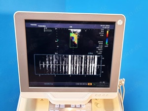 Toshiba Xario SSA-660A Ultraschallgerät  Bild 2