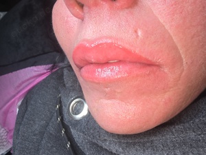 Permanent Make Up Lippen 