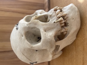 Menschlicher Schädel, medizinisch, zu verkaufen