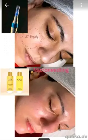 Gesichtsbehandlung Microneedling & Microdermabrasion 