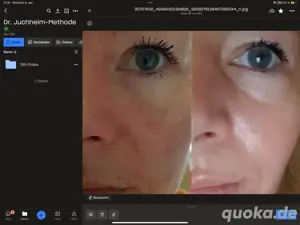 effective Kosmetik, erfolgreich Abnehmen
