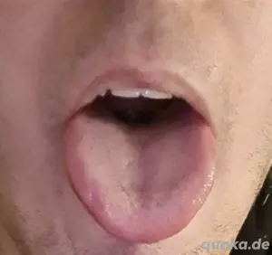 Hallo fals jemand noch ein mund sucht