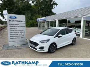 Ford Fiesta 5TG ST-Line 1.0 EcoBoost MHEV | NEU