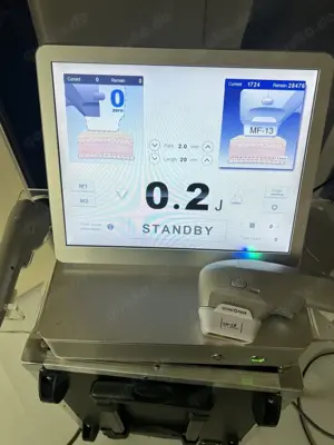 Hifu Ultraschall gerät