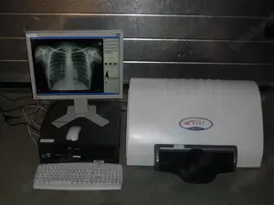Kodak Orex PcCR 1417 ACL4 Digital X-ray Röntgen Imaging 