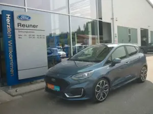 Ford Fiesta ST-Line Vignale