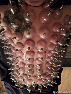 Schröpfen  Massage - gegen Verspannungen, Schmerzen, Stoffwechsel, Faszie & Energie - Körper & Geis Bild 4