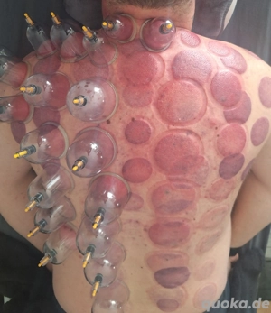 Schröpfen  Massage - gegen Verspannungen, Schmerzen, Stoffwechsel, Faszie & Energie - Körper & Geis Bild 6