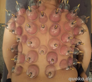 Schröpfen  Massage - gegen Verspannungen, Schmerzen, Stoffwechsel, Faszie & Energie - Körper & Geis Bild 9