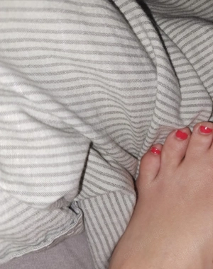 Fußbilder mit siamesischen Zehen