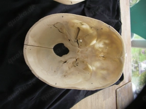 menschlicher Schädel , Zahnmedizin, Medizin, Gothic. Bild 6