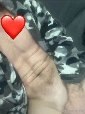 Vielmengenspritzer braucht TG