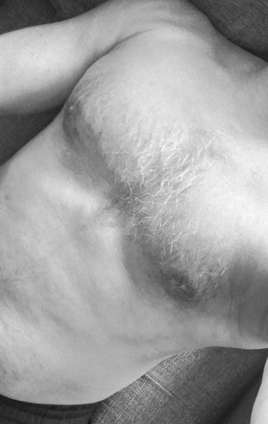 an alle vernachlässigten