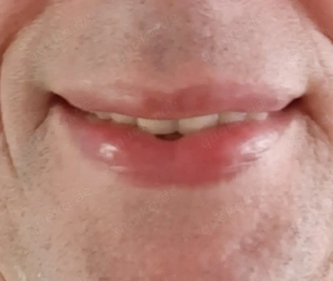 Handicapt Woman gesucht