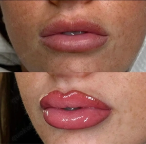 Permanent Make up Lippen Bild 3