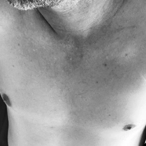 Treffen outdoor oder z.B. im Schwimmbad?