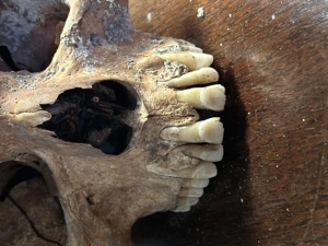 Schädel aus wissenschaftlicher Altsammlung Bild 3