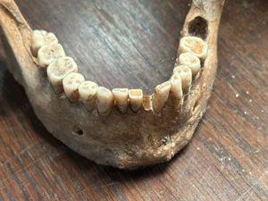 Schädel aus wissenschaftlicher Altsammlung Bild 4