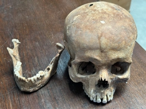 Schädel aus wissenschaftlicher Altsammlung