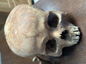 Schädel aus wissenschaftlicher Altsammlung Bild 2