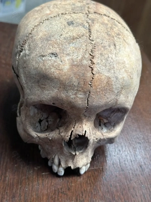 Schädel aus wissenschaftlicher Altsammlung No.5 _1104