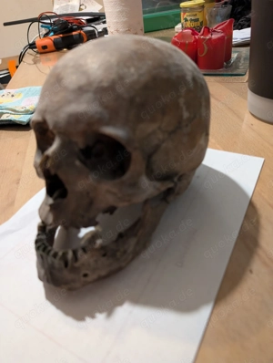 Echter menschlicher Schädel aus medizinischem Nachlass (Chirurgie)