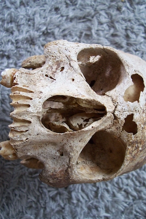 2 Menschliche Schädel