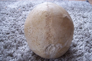 2 Menschliche Schädel (200 pro Stück ) Bild 10