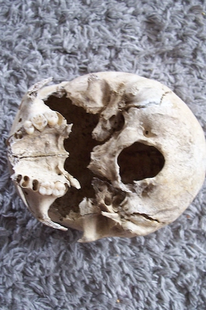 2 Menschliche Schädel (200 pro Stück ) Bild 9