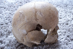2 Menschliche Schädel (200 pro Stück ) Bild 8