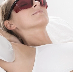 Haarentfernung Laser