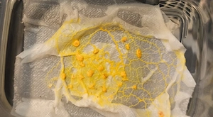 Slime mold, Schleimpilze, Blob