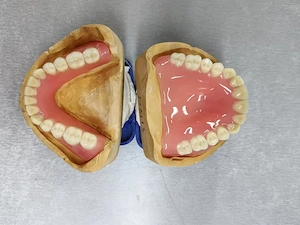 Denture Dental Lab, Zirconia Dental Crown and PFM Dental Crown