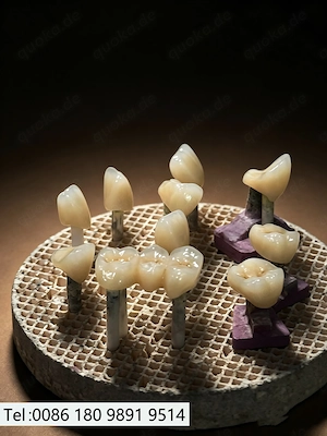 CAD CAM 3D Crown & Bridge Lab USA | Digital Dentures Lab CAD CAM 3D 
