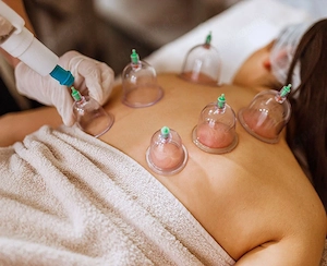   Hijama | Traditionelles Schröpfen | Hagen & Umgebung