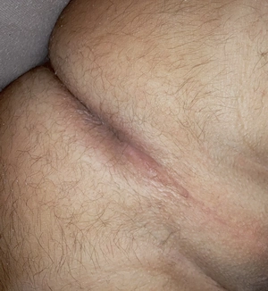 Fesseln und komplette Rasur 
