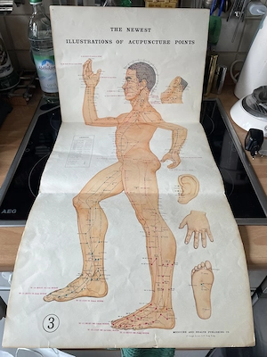Akupunktur Poster 3 er Set aus den 70 ern